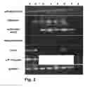 Fig. 04 - Methods of culturing cells in a medium comprising transforming growth factor beta 1 and basic fibroblast growth factor