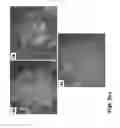 Fig. 06 - Methods of culturing cells in a medium comprising transforming growth factor beta 1 and basic fibroblast growth factor