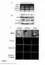 Fig. 02 - COMPOSITIONS AND METHODS FOR DETECTING AND TREATING PROSTATE CARCINOMA