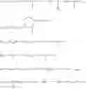 Fig. 07 - MICROPARTICLES COMPRISING SOMATOSTATIN ANALOGUES