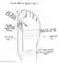 Fig. 01 - Bunion belt big toe straightner