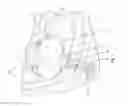 Fig. 02 - Compressive Device for Percutaneous Treatment of Obesity