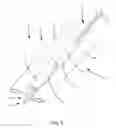 Fig. 02 - Posterior cervical fusion system and techniques