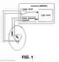 Fig. 02 - Method and Device for Treating Cardiac Arrhythmias
