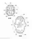 Fig. 07 - Urinary incontinence device and method