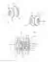 Fig. 02 - Speech valve, a tool for facilitating insertion of a speech valve and a tool for holding a speech valve