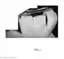 Fig. 03 - DANCE EQUIPMENT FOR HANDS