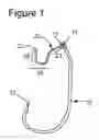 Fig. 02 - BAIT HOLDER FOR FISHING HOOK