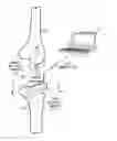 Fig. 01 - Prosthetic component having a compliant surface