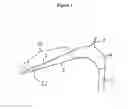 Fig. 02 - Bubble reducer for eliminating gas bubbles from a flow