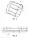 Fig. 02 - Expandable packer with expansion induced axially movable support feature