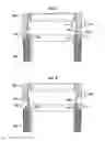 Fig. 11 - Metal expandable element back-up ring for high pressure/high temperature packer