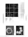 Fig. 32 - Three dimentional (3D) robotic micro electro mechanical systems (MEMS) arm and system