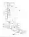Fig. 02 - Link carrier apparatus for a drilling rig