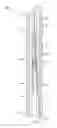 Fig. 01 - Lateral well drilling apparatus and method