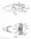Fig. 10 - Safety line traveller