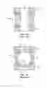 Fig. 02 - Ball valve having multiple moveable seats