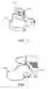 Fig. 09 - Methods and systems for treatment of vestibular disorders