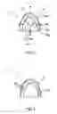 Fig. 04 - Lighting Device Comprising a Bulb