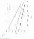 Fig. 37 - Extremely high speed broadband access over copper pairs