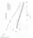 Fig. 38 - Extremely high speed broadband access over copper pairs