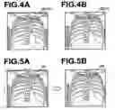 Fig. 04 - ALIGNING APPARATUS, ALIGNING METHOD, AND THE PROGRAM
