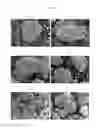 Fig. 06 - Method for extracting rare earth material from monazite