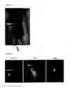 Fig. 35 - Tetraaza macrocyclic compound, preparation method thereof and use thereof