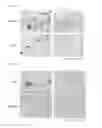 Fig. 04 - Antibody recognizing turn structure in amyloid β
