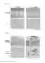 Fig. 05 - Antibody recognizing turn structure in amyloid β