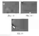 Fig. 02 - Methods and formulations for treating chronic liver disease