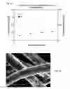 Fig. 07 - BIODEGRADABLE FIBER AND FIBER WADDING FOR FILLING BONE DEFECTS AND METHOD FOR PRODUCING THE SAME