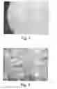 Fig. 02 - Composition comprising biodegradable hydrating ceramics for controlled drug delivery