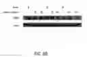 Fig. 09 - ANTI-NEOPLASTIC COMPOSITIONS COMPRISING EXTRACTS OF BLACK COHOSH