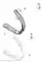 Fig. 02 - Dental appliance