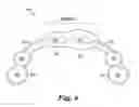 Fig. 07 - Dental appliance