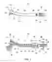 Fig. 02 - Illuminating dental instrument, coupling and method of use