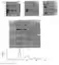 Fig. 01 - MASP 2, a complement-fixing enzyme, and uses for it