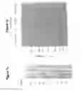 Fig. 02 - MASP 2, a complement-fixing enzyme, and uses for it