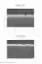 Fig. 12 - Carbon nanotube forming method and pre-treatment method therefor