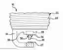 Fig. 01 - Method of manufacturing a spark plug having a platinum alloy electrode