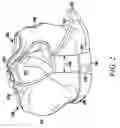 Fig. 04 - Exercise garment