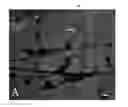 Fig. 01 - Modulating neuromuscular junction density changes in botulinum-toxin treated tissue