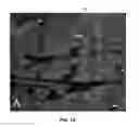 Fig. 02 - Modulating neuromuscular junction density changes in botulinum-toxin treated tissue