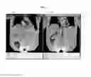 Fig. 03 - Method and System for MR Scan Range Planning