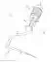 Fig. 02 - PERIODONTAL FORCE PROBE