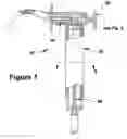 Fig. 02 - Device for removing a lodged mass