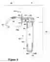 Fig. 07 - Device for removing a lodged mass