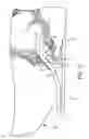 Fig. 10 - Method, Apparatus and System for Preventing or Reducing the Severity of Hemorroids