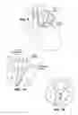 Fig. 08 - Transvascular electrode system and method